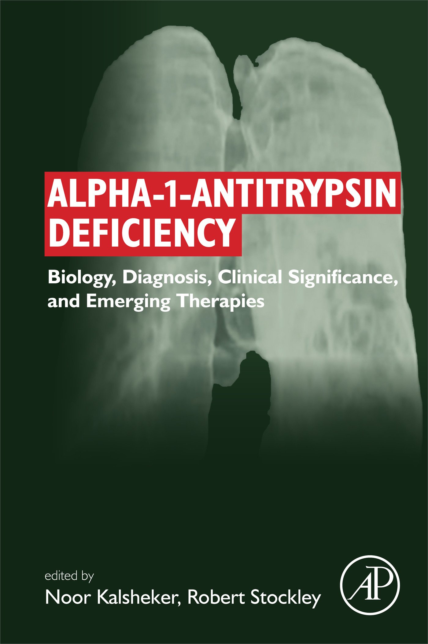 alpha 1 antitrypsin deficiency 004