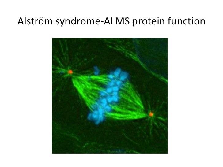 alstrm syndrome 11 728