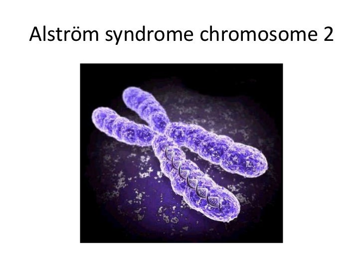 alstrm syndrome 8 728